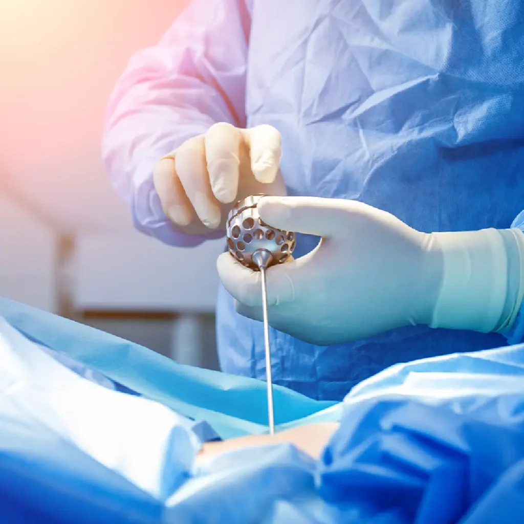 endoscopic-spine-surgery