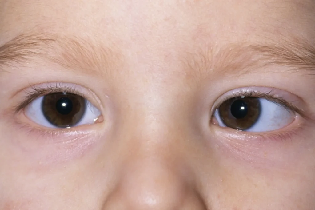 eye doctor for children