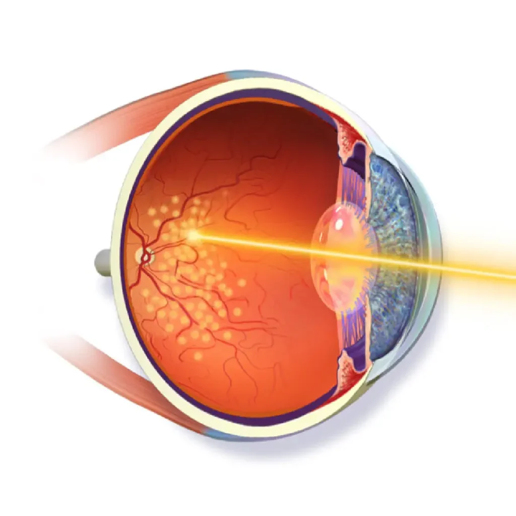 Retina specialist in Dubai performing a detailed eye examination.