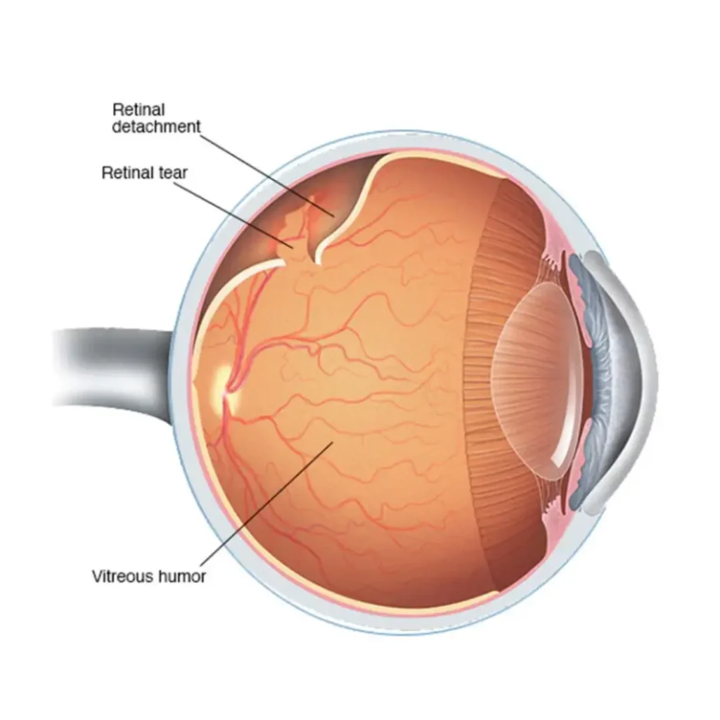Retina specialist in Dubai performing a detailed eye examination.