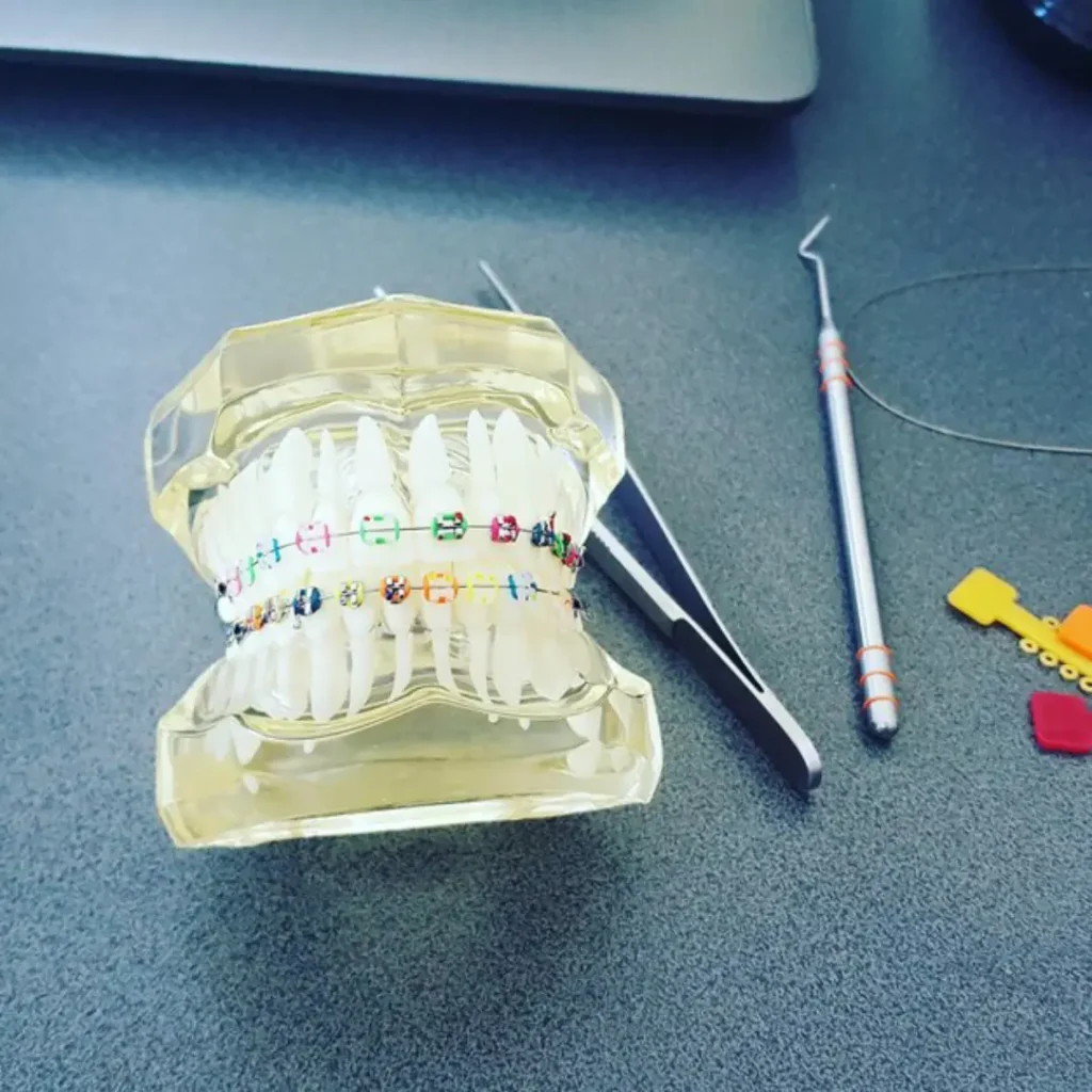 Orthodontic treatment dubai at our clinic with Myobrace