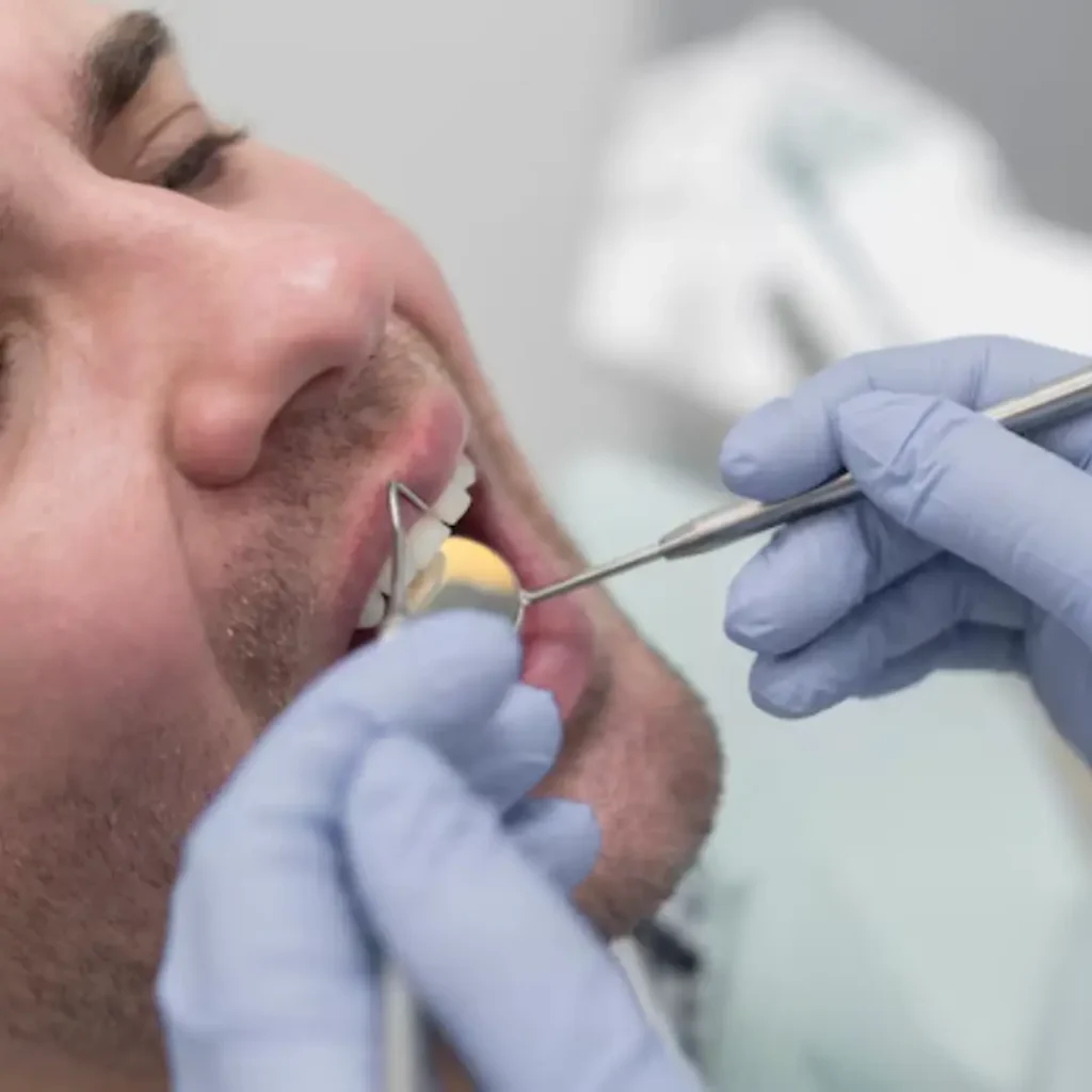 General dentistry gum treatment in Dubai at Quirónsalud Specialty Hospital