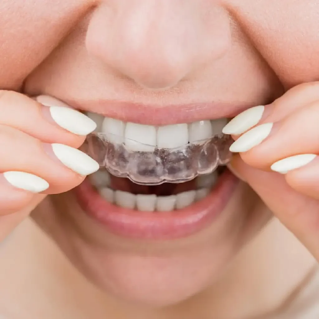 Orthodontic treatment dubai at our clinic with Invisalign.