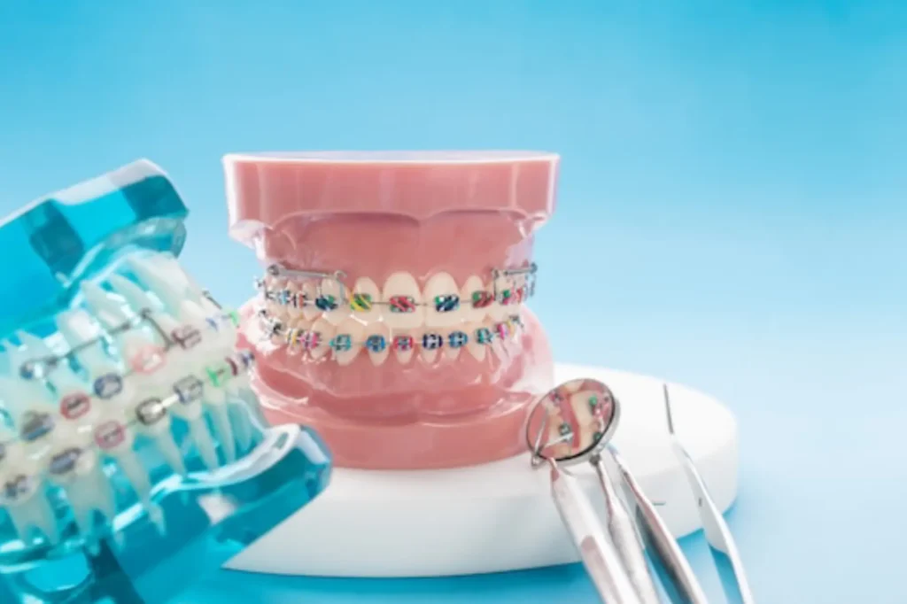 Invisalign and traditional braces options at Dubai orthodontics clinic
